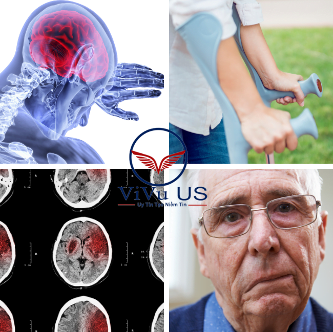 Nguy Hiểm Bệnh Rối Loại Tiền đình Gây Nên