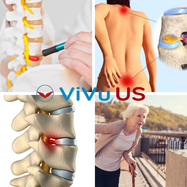 THOÁT VỊ ĐĨA ĐỆM NGUY HIỂM KHÔNG ?