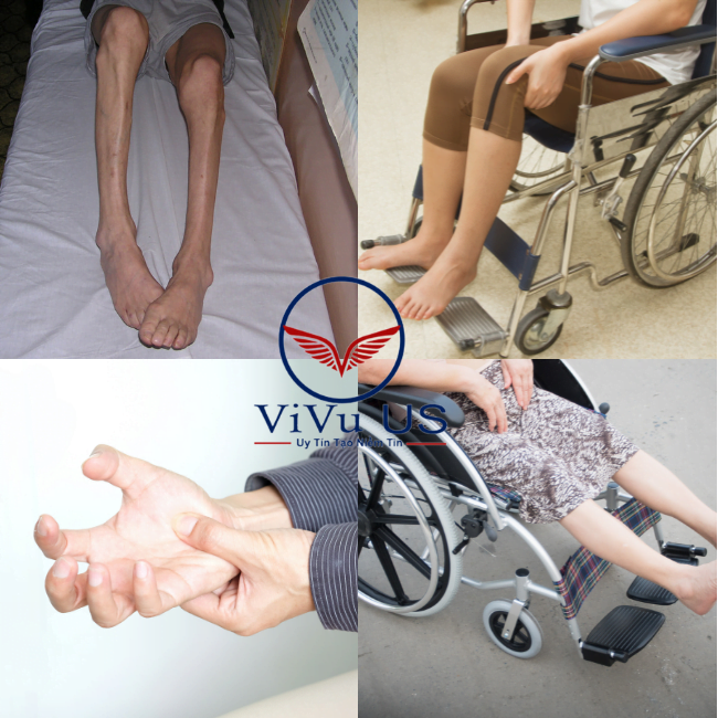 Glucosamine HCL 1500mg 375 viên