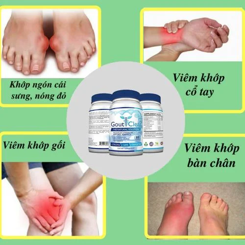 Viên Uống Gout Clear 60 Viên Usa (Cao Cấp) 8 Thuốc Hỗ Trở Trị Bệnh Gout Tốt Nhất Hiện Nay - Goutclear