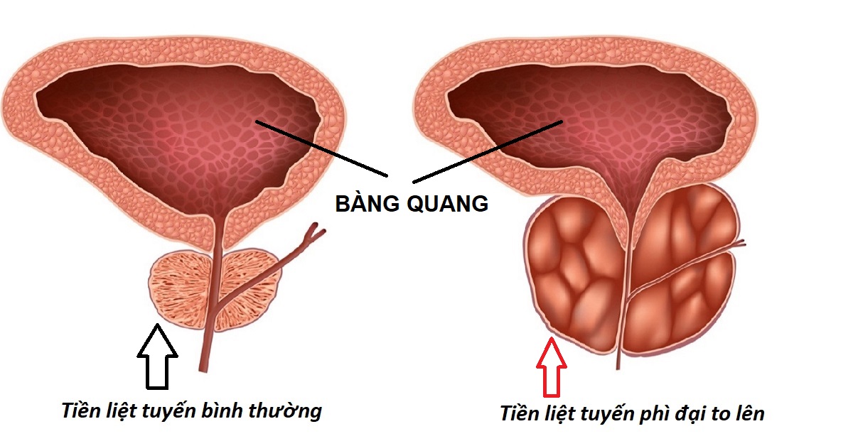 Phi Dai Tien Liet Tuyen 16794795001921789956044